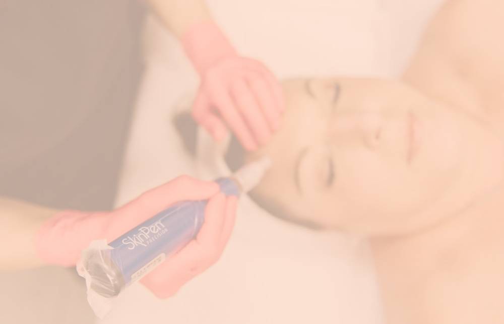 Microneedling