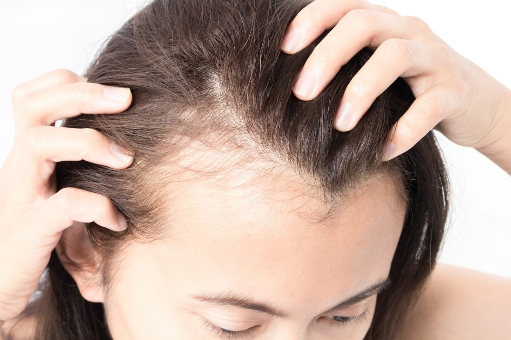 treatments for hair loss and aging