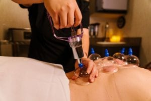 Cupping Therapy at Revive Medical Spa