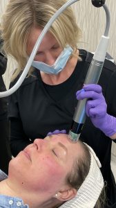 RF Microneedling to lift and tighten skin