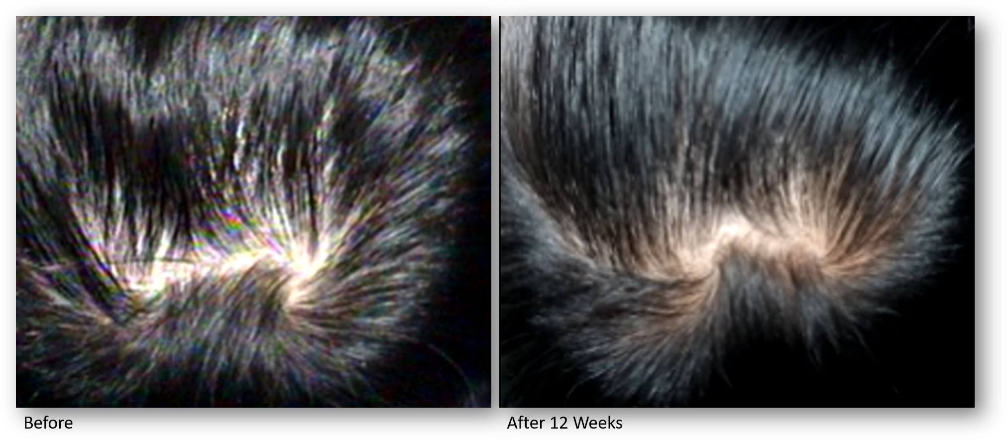 KeraLase hair Restoration