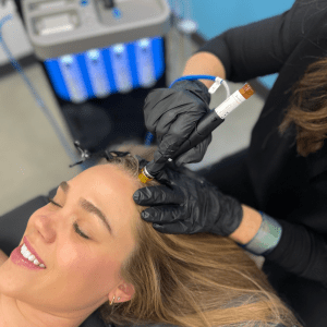 Keravive, a Hydrafacial for the scalp