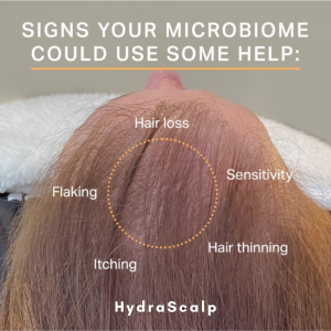 Keravive, a Hydrafacial for the scalp