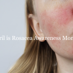 Rosacea skincare