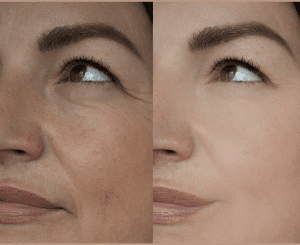Anti-Aging Solutions at Revive Medical Spa