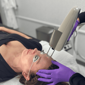 Pearl Laser at Revive MedicalSpa and Advanced Dermatology & Skin Cancer Center