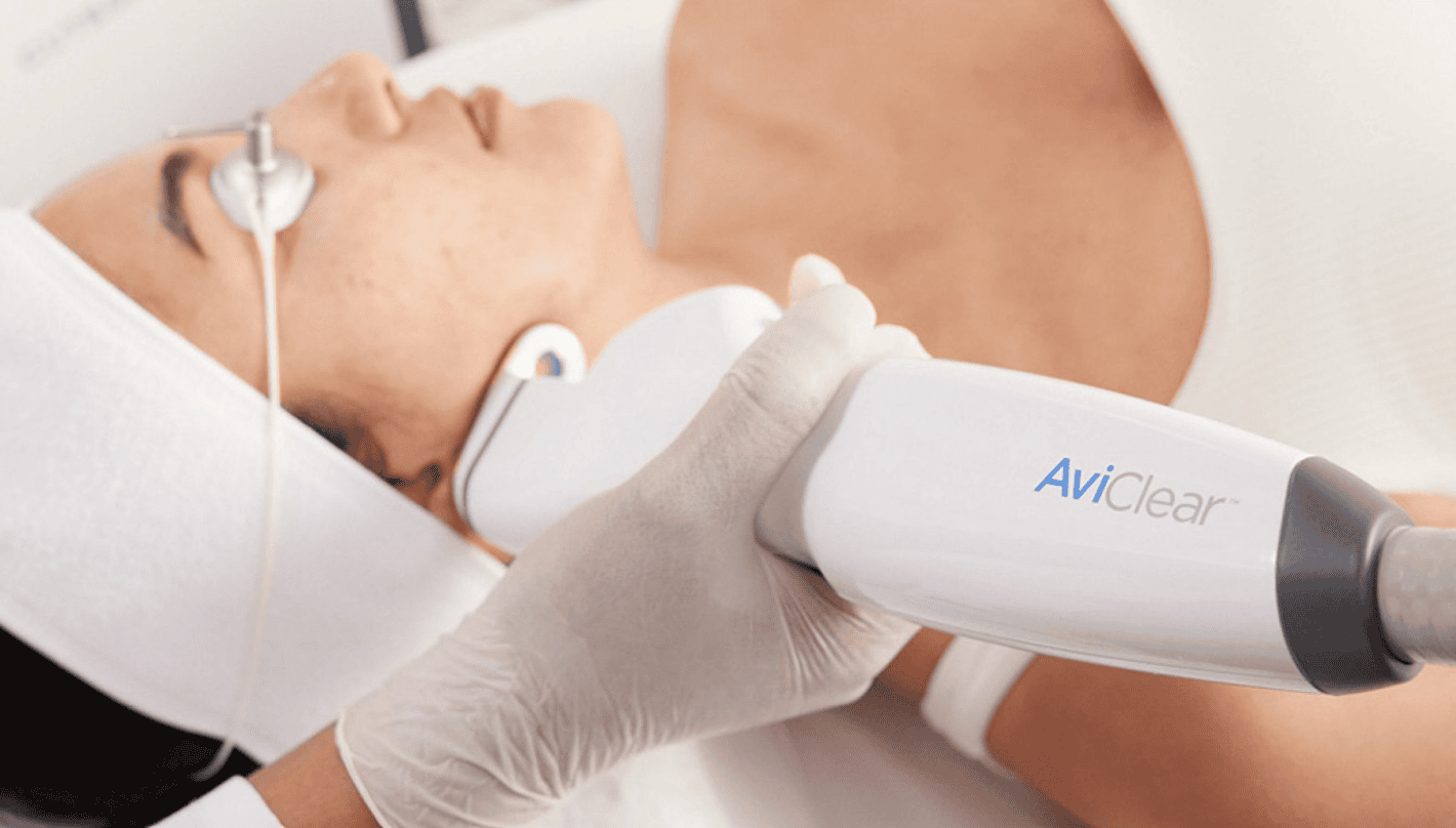 AviClear Acne Treatment Revive Medical Spa Fayetteville
