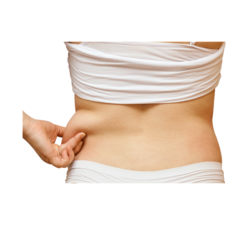 CoolSculpting Elite Abs Flanks