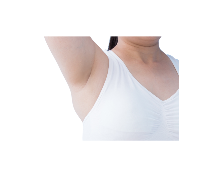 CoolSculpting Elite Bra Fat and Back Fat