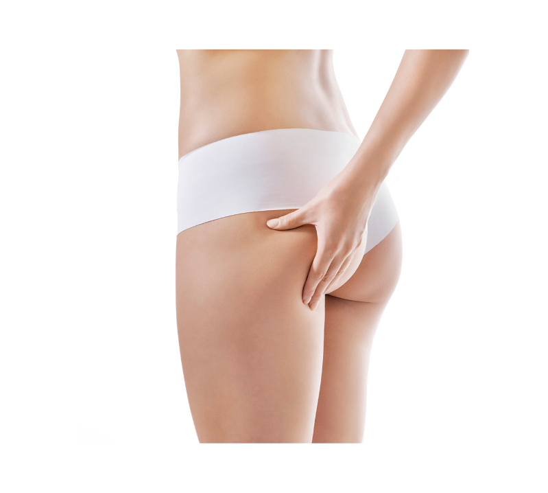 CoolSculpting Elite Buttocks Banana Roll