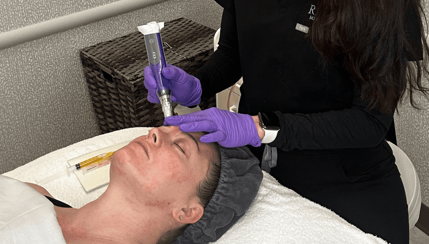 SkinPen Microneedling Revive Medical Spa
