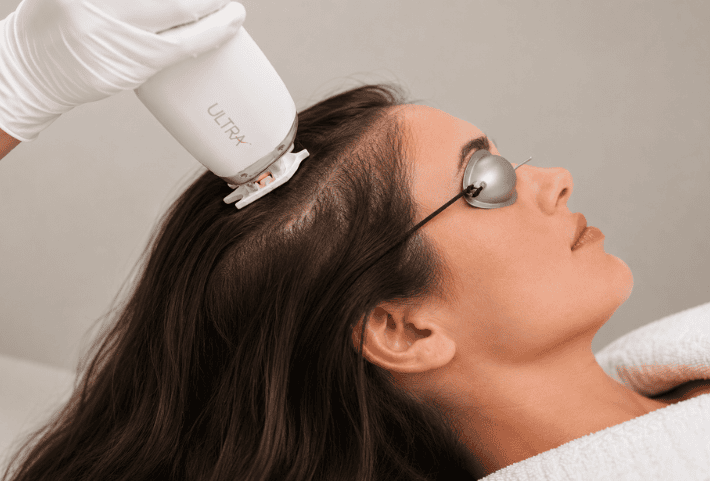 Hair Loss Treatment at Revive Medical Spa